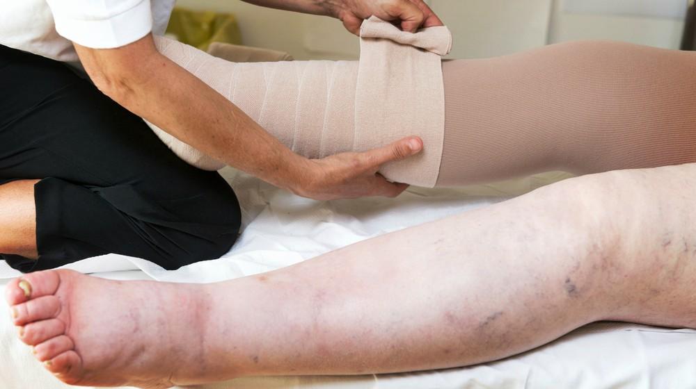 Frequently Asked Questions Regarding Wearing Compression Bandages -  Lymphedema Therapy Specialists