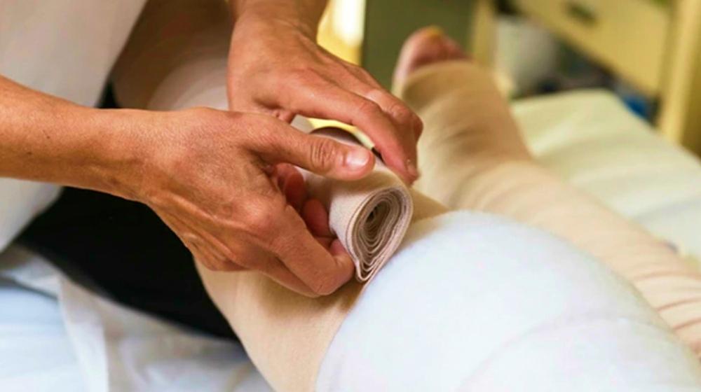 What Are The Stages of Lymphedema